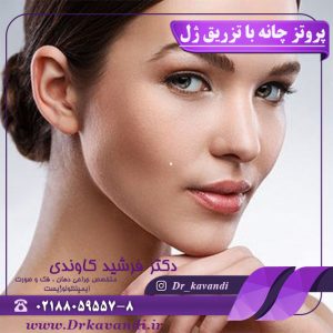 پروتز چانه با تزریق ژل
