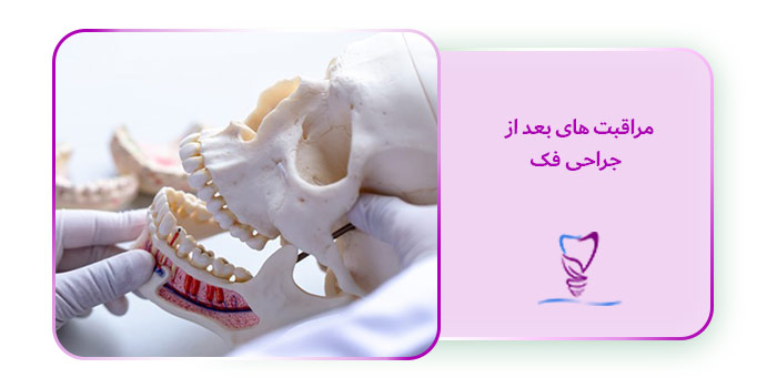 مراقبت های بعد از جراحی فک