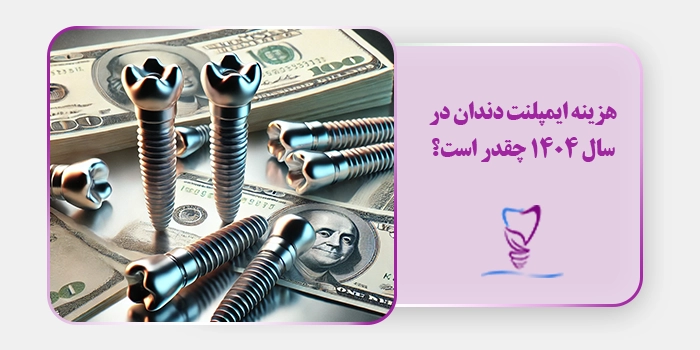 هزینه ایمپلنت دندان در سال 1404 چقدر است؟