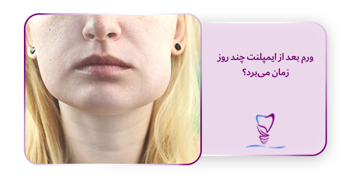 ورم بعد از ایمپلنت چند روز زمان میبرد؟