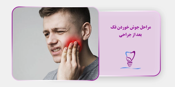 مراحل جوش خوردن فک بعد از جراحی