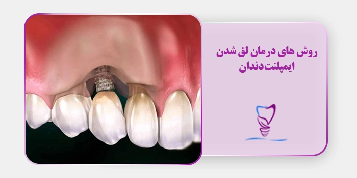 روش های درمان لق شدن ایمپلنت دندان