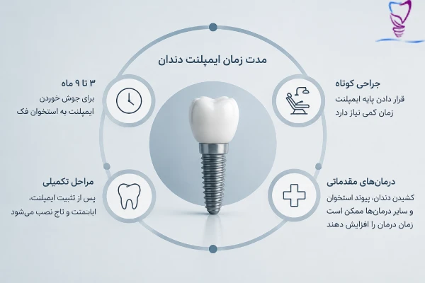 مدت زمان ایمپلنت دندان